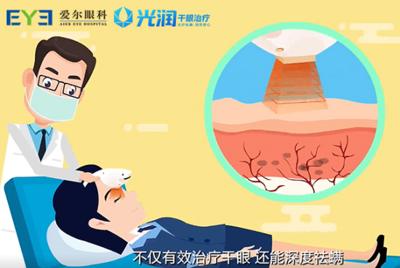 愛爾眼科干眼癥全系診療服務,量“眼”打造個性化治療方案
